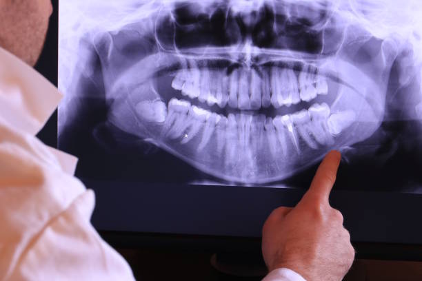Best Weekend Emergency Dentist in Lynn, IN